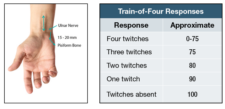 Train-of-Four Responses